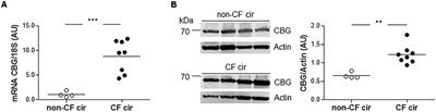 Opposite Expression of Hepatic and Pulmonary Corticosteroid-Binding Globulin in Cystic Fibrosis Patients